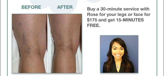 Buy a 30-minute service with Rose for your legs or face for $175 and get 15-minutes free